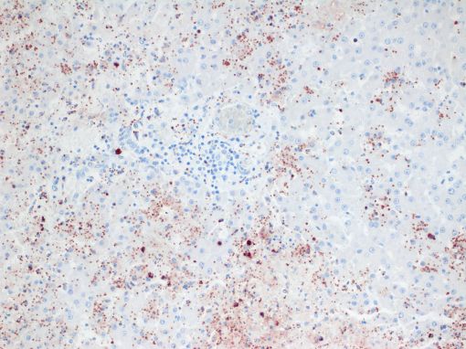 favorilere ekle immunohistochemistry home about us content forum photo gallery guest book contact antigens ae1 ae3 pan cytokeratin img1 asma alpha smooth muscle actin asma asma 2 sma 3 asprosin asprosin bvd md bovine viral diarrhea