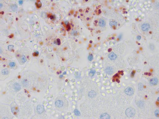 favorilere ekle immunohistochemistry home about us content forum photo gallery guest book contact antigens ae1 ae3 pan cytokeratin img1 asma alpha smooth muscle actin asma asma 2 sma 3 asprosin asprosin bvd md bovine viral diarrhea