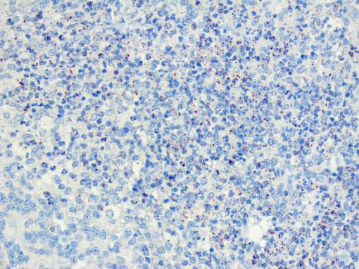  listeria  listeria spp bovine tissue immunohistochemistry