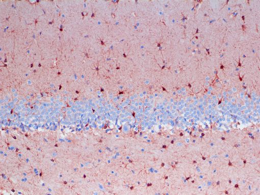  S100A6 S100 dog cat feline canine immunohistochemistry