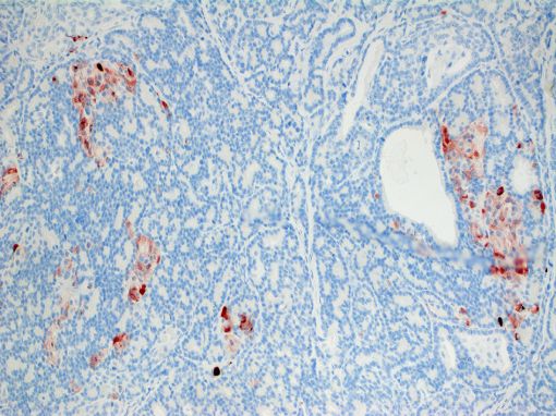 Chormogranin A Cat - Feline tissue Dako. ABC-peroxidase complex, immunohistochemistry