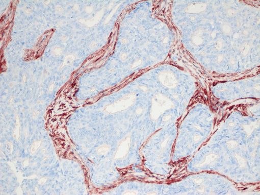  Alpha smooth muscle actin (aSMA, SMA). Dog - Canine tissue immunohistochemistry