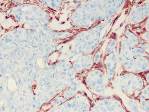  immunohistochemistry - alpha smooth muscle actin - canine - dog