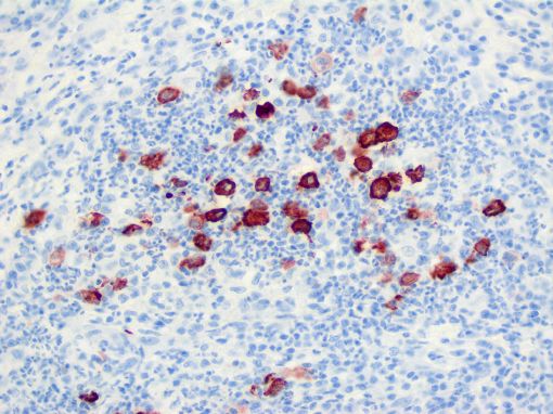  feline infectious peritonitis virus  Cat - Feline tissue  ABC-peroxidase complex, immunohistochemistry